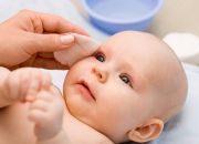 Trẻ sơ sinh bị ghèn vàng ở mắt phải làm sao?