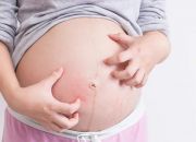 Mẹ bầu bị ngứa toàn thân trong có nguy hiểm cho thai nhi không?