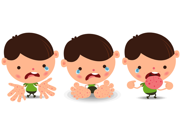 Phòng ngừa các bệnh thường gặp cho trẻ