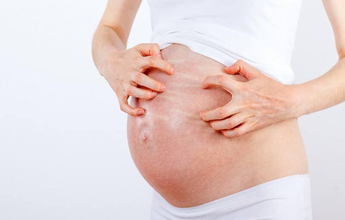 Mẹ bầu bị ngứa toàn thân có ảnh hưởng thai nhi không?